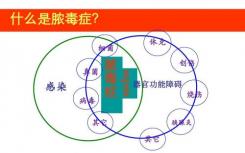 南卡罗来纳医科大学的科学家发现新疗法可有效治疗脓毒症