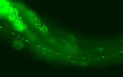 鉴定出新的神经变性分子