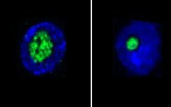 Nucleolus是预期寿命的预测因子