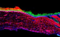 愈合的炼金术:研究人员把打开的伤口变成皮肤