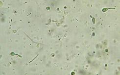 比较真菌分泌物以揭示碳化合物降解途径