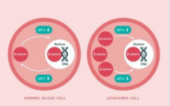 白血病细胞生长机制显示促使新的治疗希望