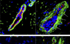 科学家在培养皿中培养出完美的人体血管
