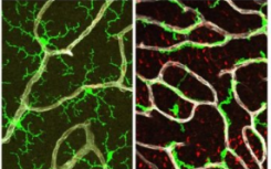 有缺陷的分子主开关可能有助于AMD