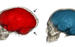 尼安德特基因揭示了现代人类大脑的独特方面