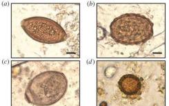 来自中世纪厕所的寄生虫揭开了人类历史的秘密