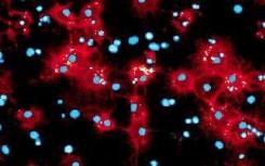 科学家开发出更有效地产生脑干细胞的新方法