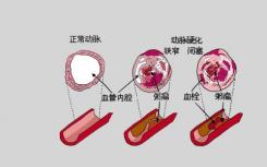 研究重点需要使人口水平的遗传数据多样化以便更好地预测疾病