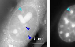 在海洋生物实验室发明的显微镜照亮染色体'暗物质'