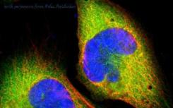 Human Cell Atlas希望揭开隐藏在我们基因中的神秘面纱