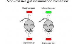 合成生物学家设计炎症感应肠道细菌