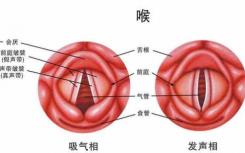 慢性咽炎是我们生活中最常见的疾病