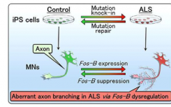 研究人员找到了一种新的ALS病理介质