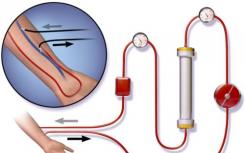 CVS推出家用血液透析装置临床试验