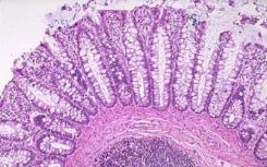 科学家发现肠道细胞会影响生物钟