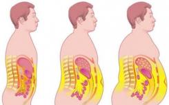 腰部脂肪的堆积比肥胖引起的并发症更为严重