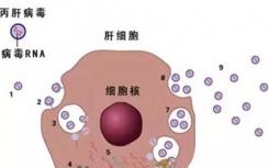 城市急诊室发现丙型肝炎感染率很高